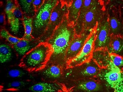 Phenotypic Characteristics Of Human Dermal Microvascular Endothelial