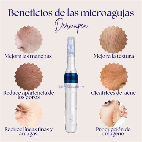 HOLA Amiguixx Hoy Les Quiero Hablar Sobre Las Microagujas Una