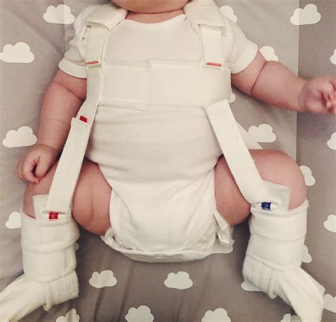 Our Hip Dysplasia Journey From Double Nappies To The Pavlik Harness