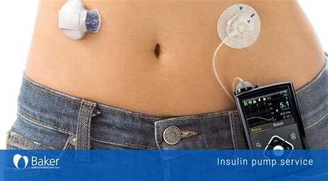 Insulin pump service