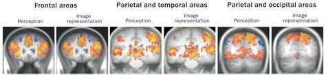 What Is Aphantasia Causes Symptoms And Treatment