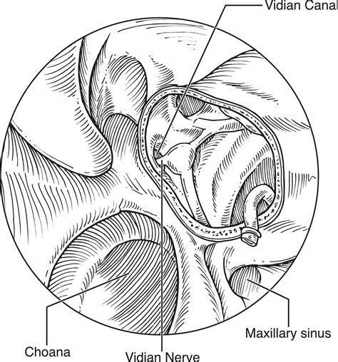 Endoscopic Resection Of Juvenile Nasopharyngeal Angiofibromas