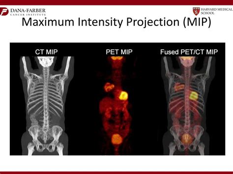 PPT Introduction To PET CT In Oncology Practical Aspects PowerPoint