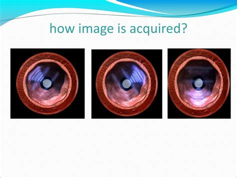 Ppt Angiography Powerpoint Presentation Free Download Id 5177574