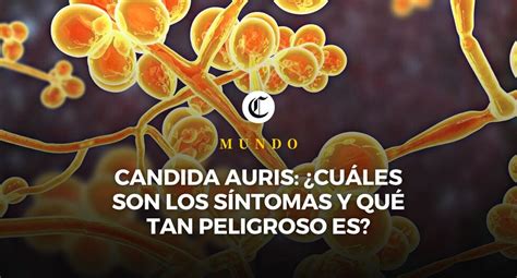 Candida Auris Provoca Alarma En Estados Unidos Qu Es Cu Les Son Sus