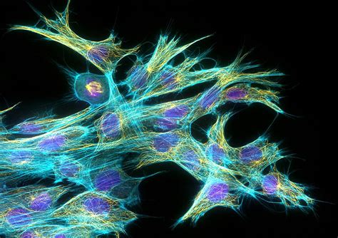 Fibroblast Cells, Fluorescent Micrograph Photograph by Dr Torsten Wittmann