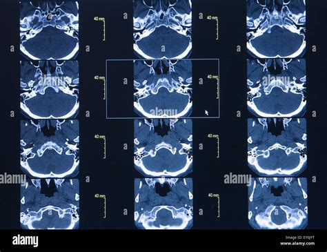 CT Scan Of Thoracic Segment Science Background Stock Photo Alamy