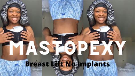 Breast Lift Without Implants Mastopexy Vlog Youtube