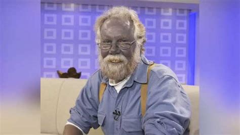 Man called 'Papa Smurf' after skin turned blue | Viral News, Times Now