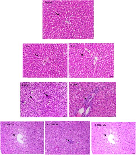 Microscopic Photograph Of Histopathological Examination Of Liver Tissue Download Scientific