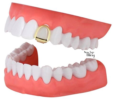Open Face Gold Crown