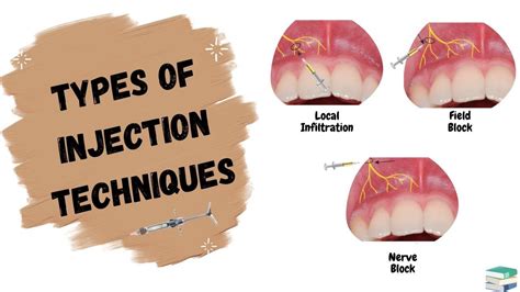 The Comprehensive Guide To Field Block Anesthesia Techniques Benefits