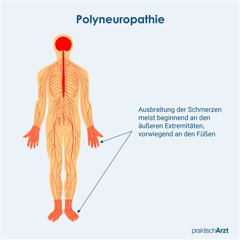 Polyneuropathie Symptome Und Behandlung Praktischarzt