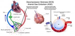 Decompression Sickness DCS Arterial Gas Embolism AGE Pediatric