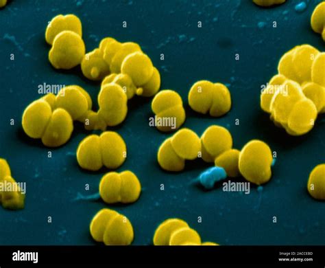 Neisseria Meningitidis Bacteria Coloured Scanning Electron Micrograph Sem Of Neisseria