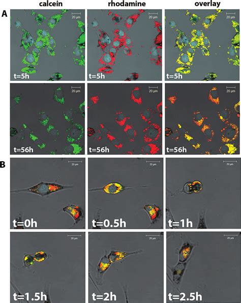 Confocal Fluorescence Time Resolved Confocal Laser Scanning Microscope