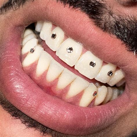 Orikkie Trend🚨 Tooth Jewelry On Instagram עבודה כל כך נקייה ומדוייקת