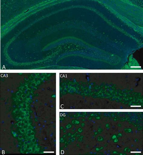 Gpr Immunoreactivity In The Hippocampus Of The Adult Mice A