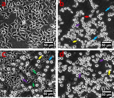 Cell Morphology Analysis In Hela Cells Cells Were Treated With Aunps