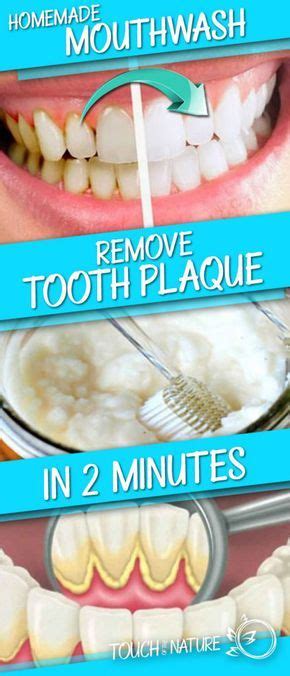 How To Remove Plaque From Teeth Instantly Howotremvo