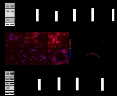 Cathepsin Maturation And Activity Is Altered In Mouse SorCS2