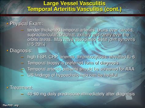 Ppt Vasculitis And Connective Tissue Disease Powerpoint Presentation Id1183241