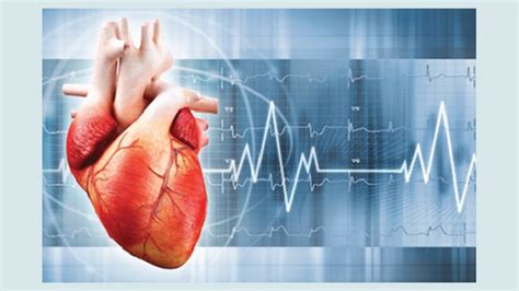 Shock Cardiogénico Definición Causas Factores De Riesgo Signos Y