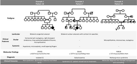 Personalized Diagnosis And Management Of Congenital Cataract By Next