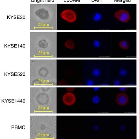 Representative Images Of Immunofluorescent Staining Of KYSE30 KYSE140