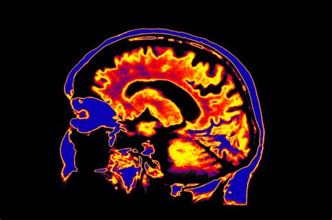 What Can a Brain Scan Tell Us About Stress and Technology?