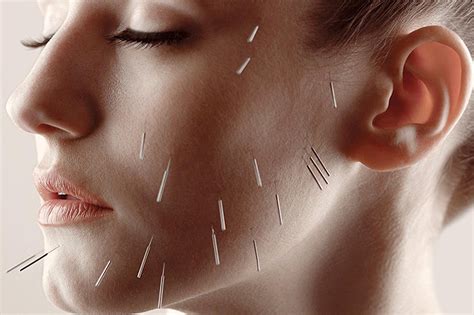 Acupuncture Points Face