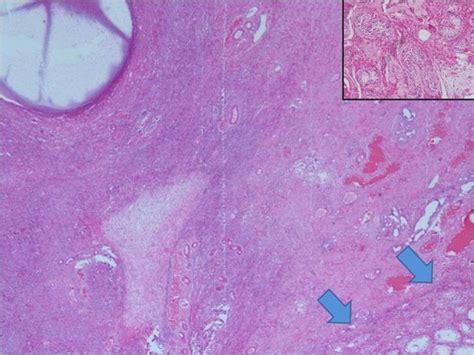 Disorders Of Sex Development A Study Of Cases PMC