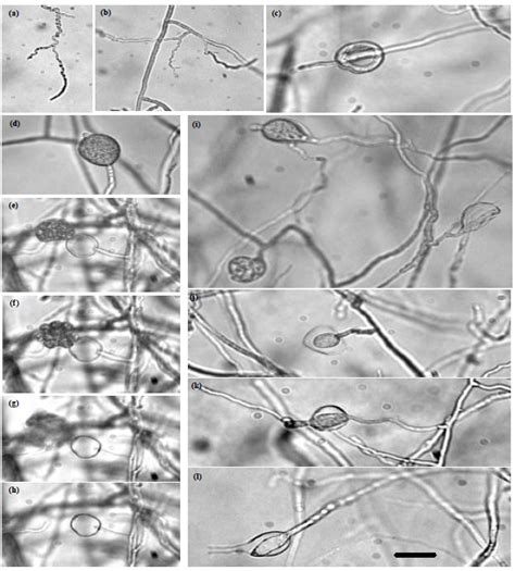 Occurrence Identification And Pathogenicity Of Pythium Aphanidermatum