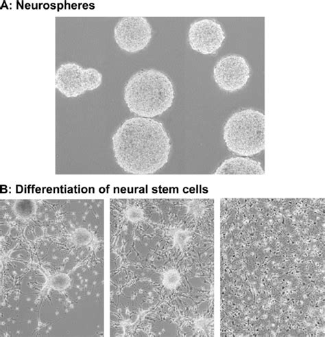 Differentiation Of Human Nscs A Nscs Derived From Human Fetal Brain