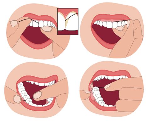 Resumen de 31 artículos como usar hilo dental actualizado