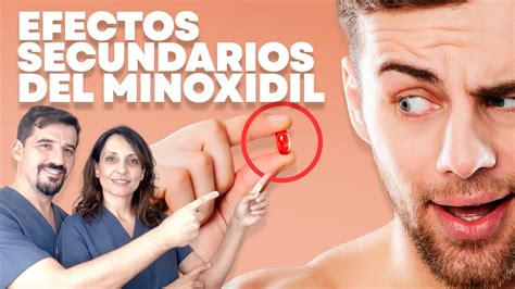 Efectos Secundarios De Minoxidil Pastillas Y Minoxidil T Pico