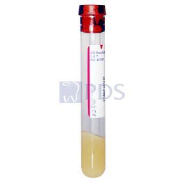 BD Vacutainer SST Tube 367987 Prime Dental Supply