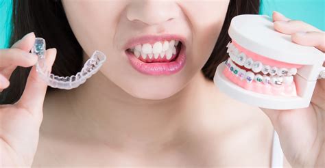 The Pros and Cons of Clear Aligners vs Traditional Braces | Byford Smiles