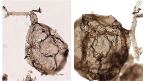 Fungus Fossils Show The Complexity Of Life A Billion Years Ago Cbc Radio