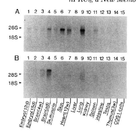 Figure 3 from A phorbol ester receptor/protein kinase, nPKC eta, a new ... 
