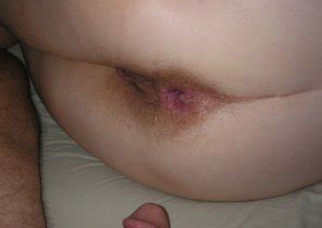 Skin Close Up Lip Nose Cheek Porn Pic