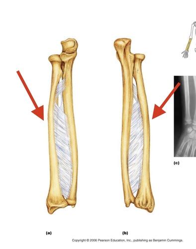 Radius And Ulna Landmarks Flashcards Quizlet