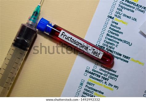 Fructosamine Test Stock Photos - 11 Images | Shutterstock