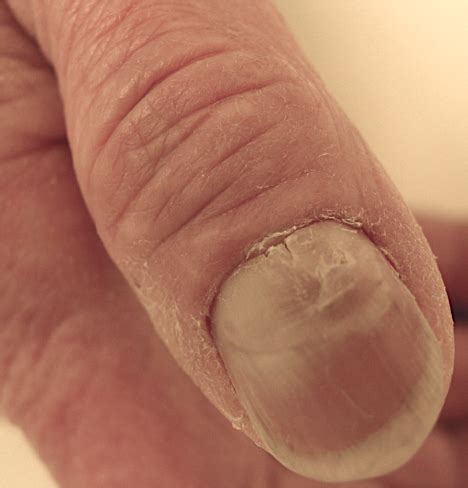 An Atlas Of Nail Disorders Part Consultant