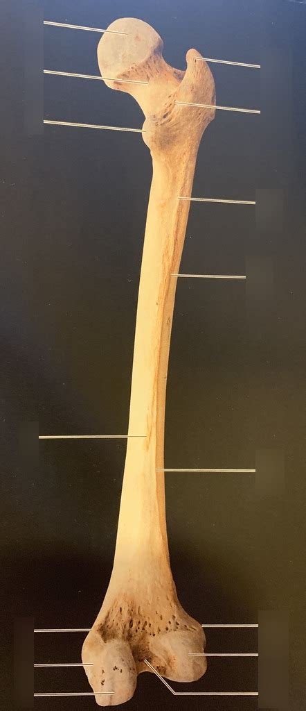 Right Femur Posterior View Diagram Quizlet