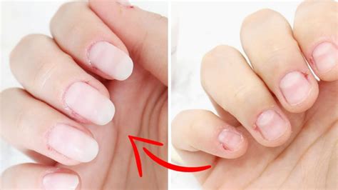 Fortifier Vos Ongles Avec De Lail Recette Maison Pour Faire Durcir