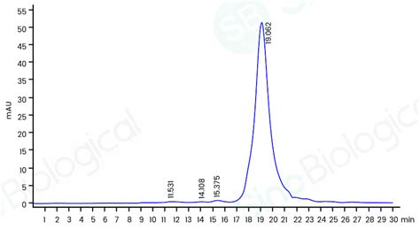 Recombinant Mouse Rbp4 Protein 50170 M08h Sino Biological