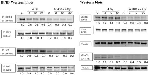 Immunoprecipitation And Western Blot Analysis Of The EGFR And Her2