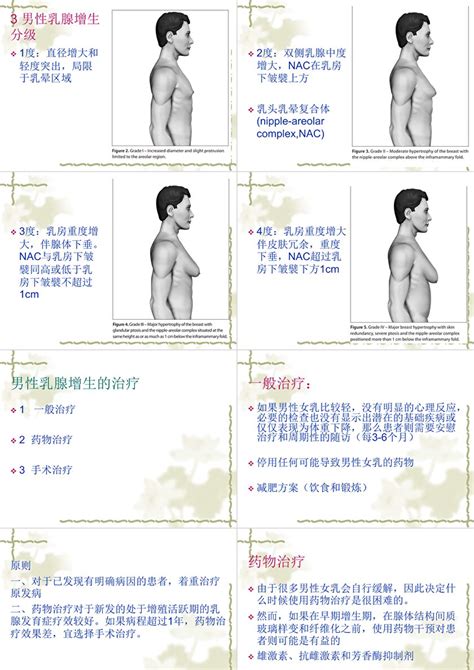 男性乳腺发育症ppt模板卡卡办公