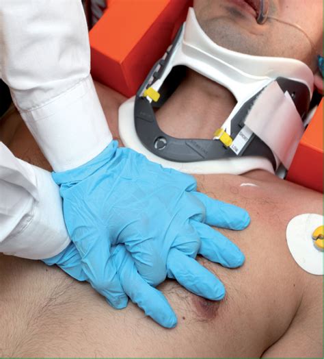 journal  paramedic practice chest compressions